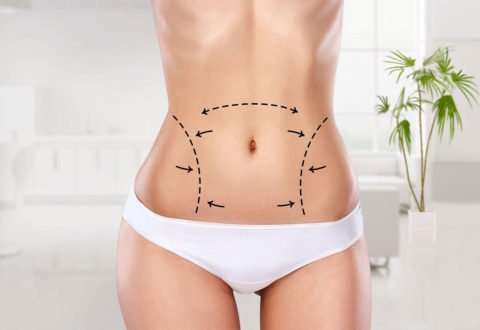 https://ctmediks.com/wp-content/uploads/2023/01/liposuction-turkey-480x330-1.jpg